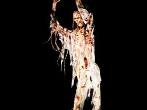 CHR2005- Male Skelerector