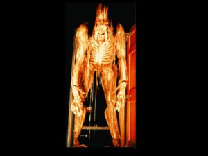 FIX606- Giant Skelerector through Door