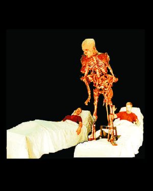 SPR2011- Springline Hospital Bed