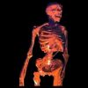 RD106- Skin Bones