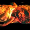 SP306- Splitting Headache