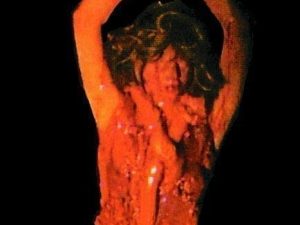 SP307- Hanging Ann Autopsy