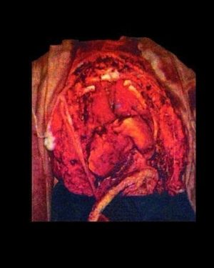 SP310- SplatterSmock